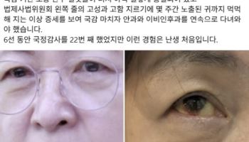 “국힘 고성 때문에…” 추미애, 눈 실핏줄 터진 사진 공개