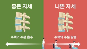 "나이 들어 키가 줄어든다면 척추질환 의심해봐야"