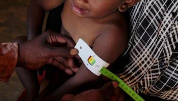 5세 미만 사망자, 올해 증가세 전환… 트럼프 원조 삭감·분쟁 여파