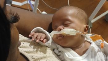 뇌사한 임신부서 강제로 키운 아기..."6개월째 중환자실"