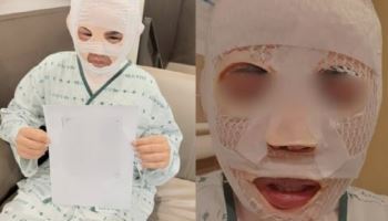 “못 생기게 만들려고” 자는 태국인 여친에 끓는 물 부은 한국男