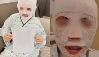 잠자던 태국인 아내 얼굴에 끓는 물 부었다…40대 男 검거