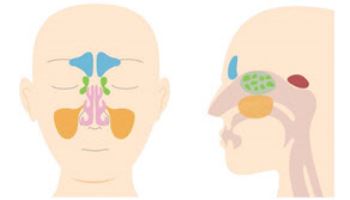 감기로 오인하기 쉬운 ‘부비동염’, 조기 진료가 필요한 이유?