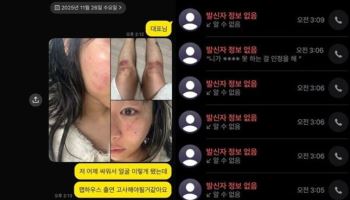 "감금하고 목 졸라"… 래퍼 재키와이, 데이트 폭력 폭로