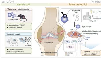 류마티스관절염 활액 내 미세플라스틱 확인 및 유해성 증명