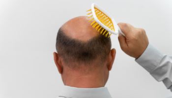 탈모인도 개미도 웃었다…李 한마디에 '불기둥'