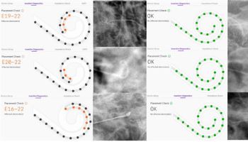 ‘인공와우 수술, 더 안전하고 정확하게’