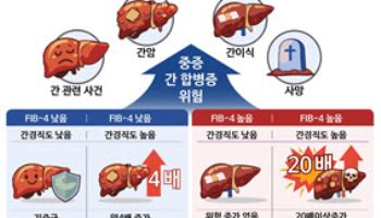 대사이상 지방간 환자, 간경직도 높으면 합병증 위험 높아