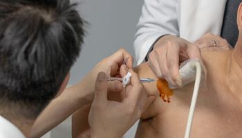 "회전근개파열, 방치하면 악화…주사치료로 기능 회복한다"