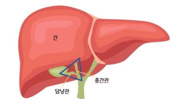 유태석 교수팀, 영상인식 AI로 담관 손상 막는 로봇담낭절제술 시행