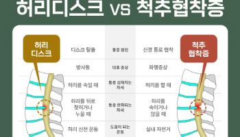 "국민병 척추질환… 증상 비슷한 허리디스크와 척추협착증 구분 필요해"