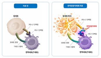 위암 면역항암제도 남녀 효과 달라...‘성차 면역학’ 고려한 치료 전략 필요