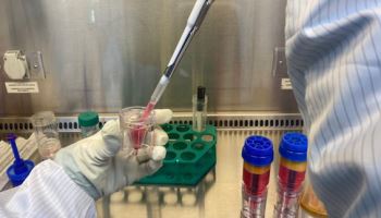 연세사랑병원, 자가지방유래 SVF 환자 분석 결과 “절반은 수도권 외 지역”