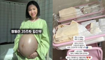 초아, 자궁경부암 극복하고 쌍둥이 아들 출산