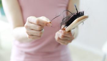복지부, 청년 탈모 건보 적용 선긋기…"의료적 필요성·비용 효과 따져봐야"