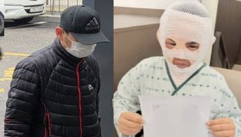 "교도소 면회도 왔는데"...'끓는 물 부은 남편'에 마음 바뀐 아내