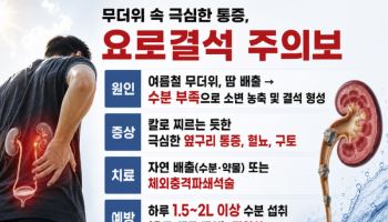 체내 수분 부족이 부르는 여름철 불청객 '요로결석' 주의해야