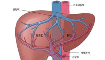 문맥종양혈전 동반 간암 환자, 방사선색전술 효과. 안전성 확인