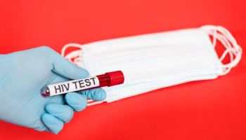 HIV 조기진단 '정확성이 핵심'…전국 검사기관 한자리에