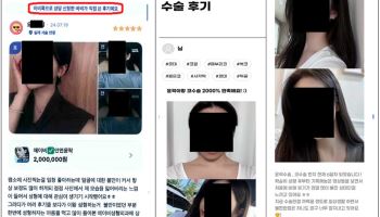 성형외과 '뒷광고' 적발…공정위 “할인받은 사실 숨기면 기만 광고”