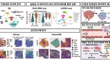 삼성서울병원 연구팀, 난치성 간질성 방광염 발병 메커니즘 규명