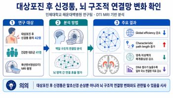 '대상포진 후 신경통, 뇌 연결망 변화와 연관성 밝혀져'