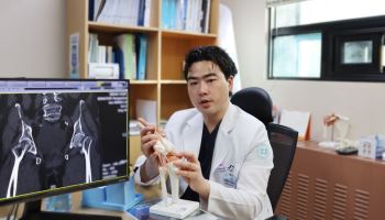 엉덩이 통증, 허리디스크만 의심하다 놓치기 쉬운 '고관절 질환'