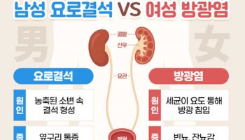 요로결석과 방광염, 여름철 체내 수분 부족이 부른 건강 적신호