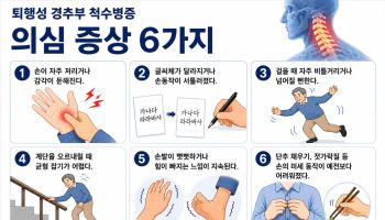 노화로 인한 척수 압박, '퇴행성 경추부 척수병증' 주의보
