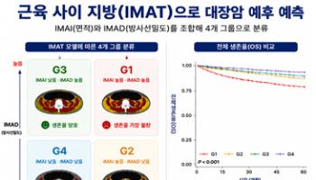 대장암 생존율, ‘근육 사이 지방’이 가른다