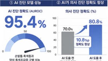 손발톱 검은 줄, AI가 흑색종 여부 가려낸다