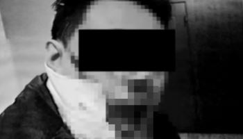 일면식 없는데 프라이팬으로 얼굴뼈 골절되게 폭행...'불구속'