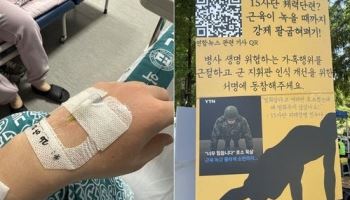 "깔짝대지 마" 강제 푸시업 100회…근육 녹아내린 병사
