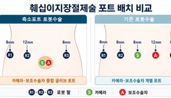 고난도 로봇 췌십이지장절제술,  절개 구멍 줄이면서 수술시간도 단축
