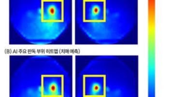 서울대병원, 망막 사진으로 치매 선별·예측하는 AI 모델 개발