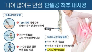 허리디스크·  척추관협착증도 척추내시경 수술로 통증 줄이고 빠른 회복 기대