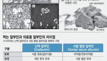 "차가버섯 섭취 후 신장 크게 손상"[안치영의 메디컬와치]