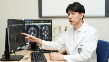 '양성 뇌종양도 안심 금물' 위치와 크기가 치료 결정의 핵심