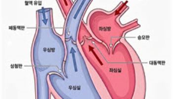 소리 없이 새는 심장 혈액, ‘심장 판막 역류증’... 조기 진단과 치료 중요