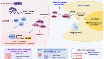 간암세포 RNA 조절 이상, 대식세포 기능 바꿔 면역 회피