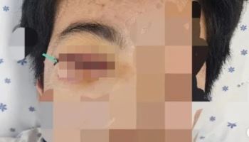 학폭에 안와골절...교장 "가해자를 보디가드로", 내 일이라면? [이슈톡톡]