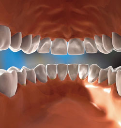 턱관절장애 환자 급증… 치아교정으로 고친다