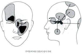 건강버라이어티 락(樂)! 두통 이야기