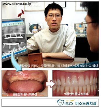 임플란트가격은 줄이고 튼튼하게