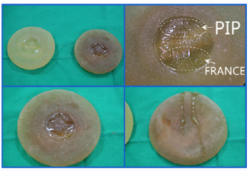발암 PIP사 유방보형물, 국내 유입 첫 확인