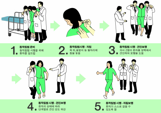 "급성요통에 주사보다 침이 효과적‥30분이면 걷는다"