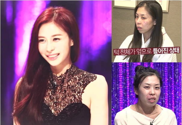 ‘렛미인4’ 무너진 반쪽얼굴 김희은, 절대미모의 동안미녀로 대 변신