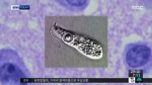 `뇌 먹는 아메바` 美 수돗물에서 발견..치사율 95%