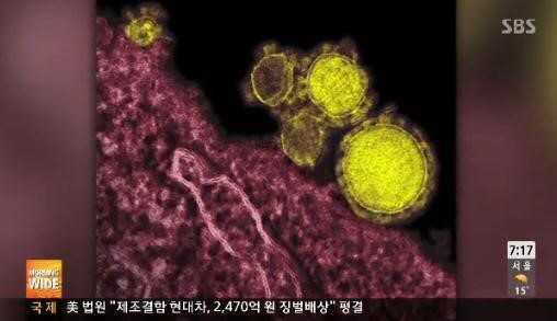 메르스 바이러스, 에볼라보다 치명적...증상은?