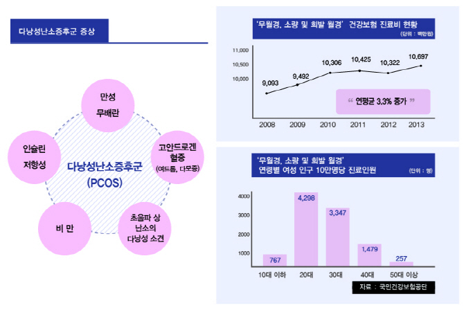 다낭성난소증후군, 2030여성 건강 '위협'